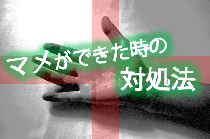 野球選手が知っておきたいマメができた時の対処